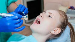 Dentists Near me for root canal