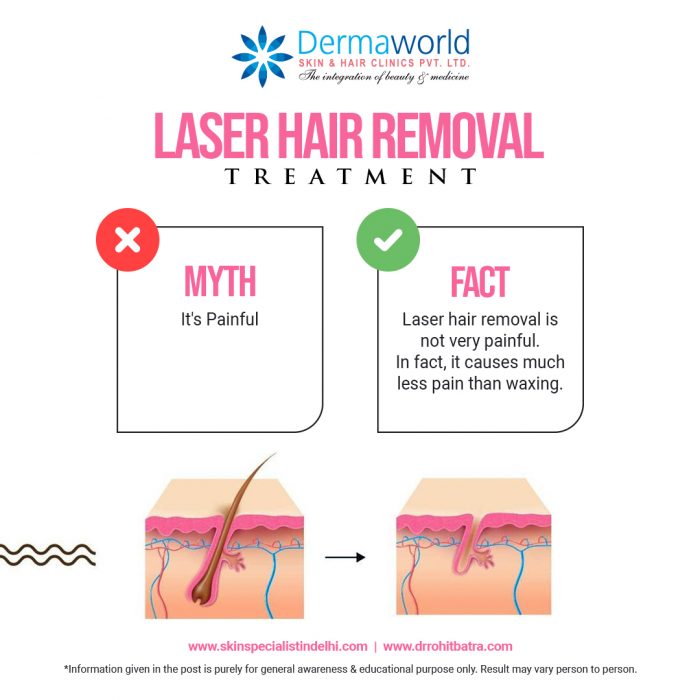 Best Laser Hair Reduction in Delhi