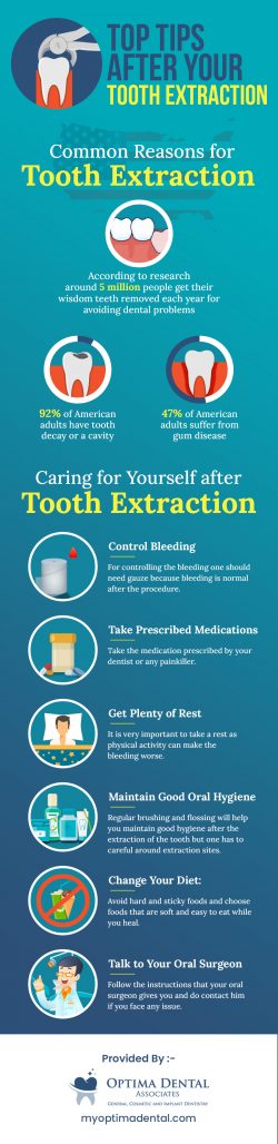 Optima Dental Associates – Wisdom Tooth Extraction in Tinley Park, IL