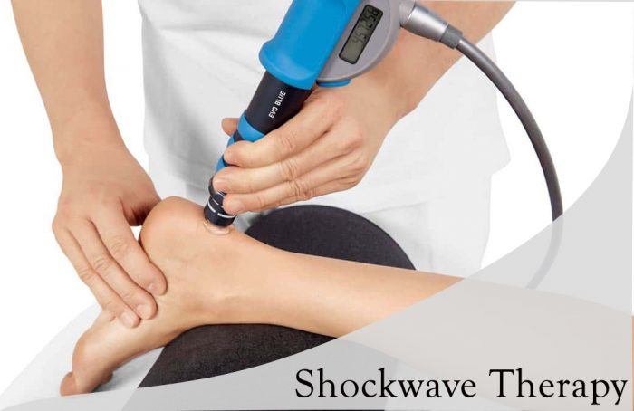 Benefits of availing of Shockwave Therapy