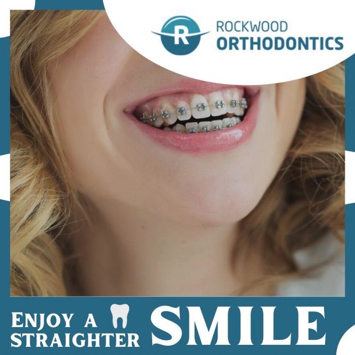 Get Advanced Orthodontic Treatments