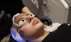 Oxygen Facial Treatment