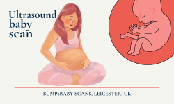 Baby Scan in Leicester, UK