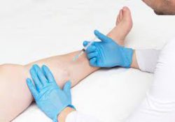 What are the qualities of the best vein doctor in NJ?