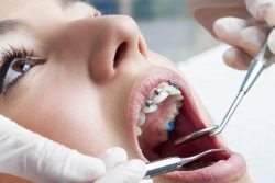 Schedule An Orthodontist Appointment