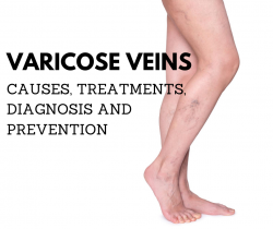 Nationally Recognized Vein Doctor | Our Veins Center in Paramus Answers FAQs