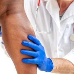 Nationally Recognized Vein Doctor | VIP Veins Center in SD Answers FAQs | veins doctor near me
