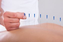 Acupuncture & Shockwave Therapy