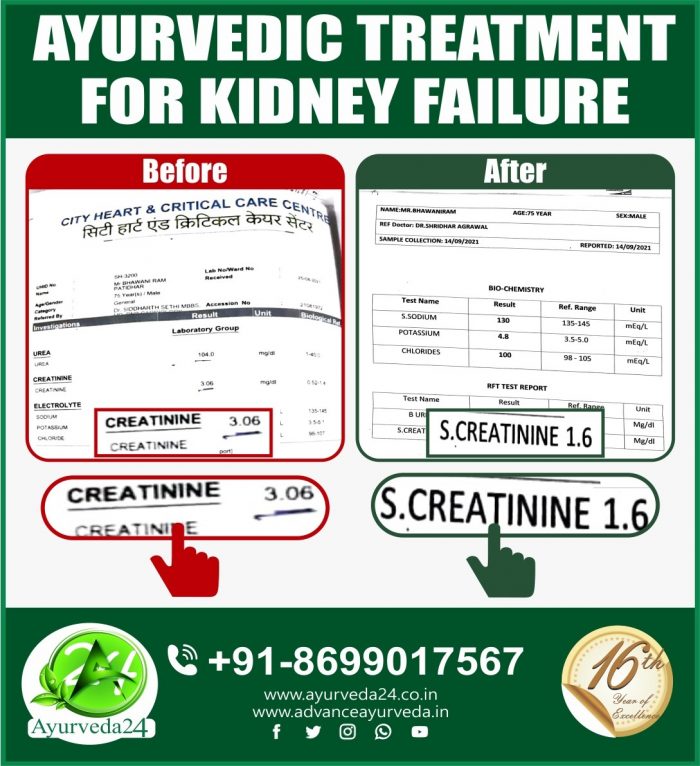 Another Success Story of 🍀🍀🍀🍀 Ayurvedic treatment for kidney failure. Many More to Come
