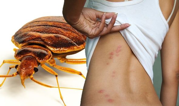 Get The Bed Bug And Flea Treatment in Delhi