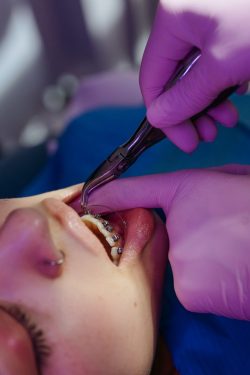 best orthodontist braces