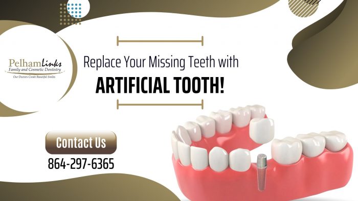 Get Your Smile Back with Implant Restoration Service