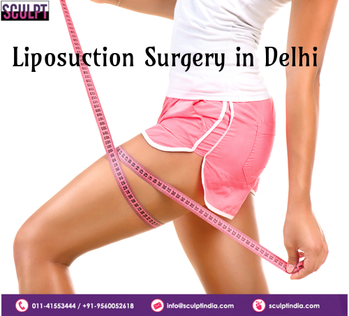 Best Liposuction Surgery in Guwahati | Sculpt India