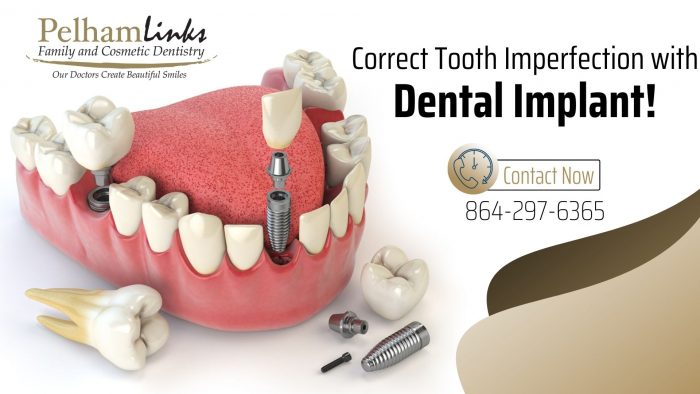 Transform Your Smile with Dental Implant
