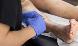 Harvard Trained Vein Doctor | What is the Best Vein Center in Long Island? | Vein Treatment Center