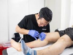 How Can I Find The Best Vein Dr. Near Me to Treat Varicose Veins? | Harvard Trained Vein Doctor