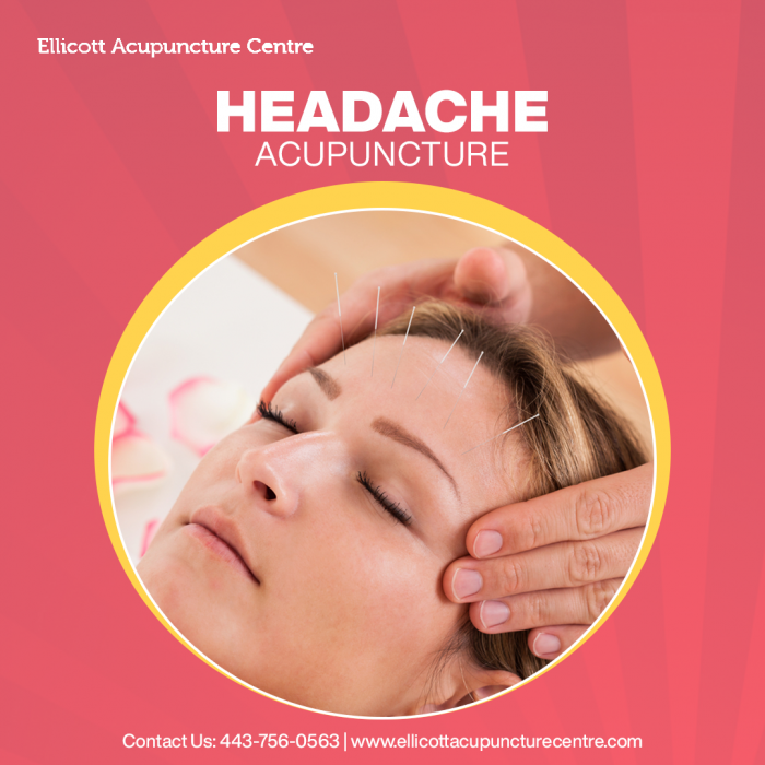 Get Headache Acupuncture Treatment