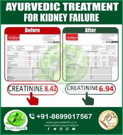 Ayurvedic Treatment For Kidney Failure