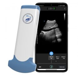 Application of the Wireless Ultrasound Transducer in Medical Treatment