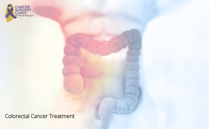 Colorectal Cancer Treatment Doctor in Mumbai