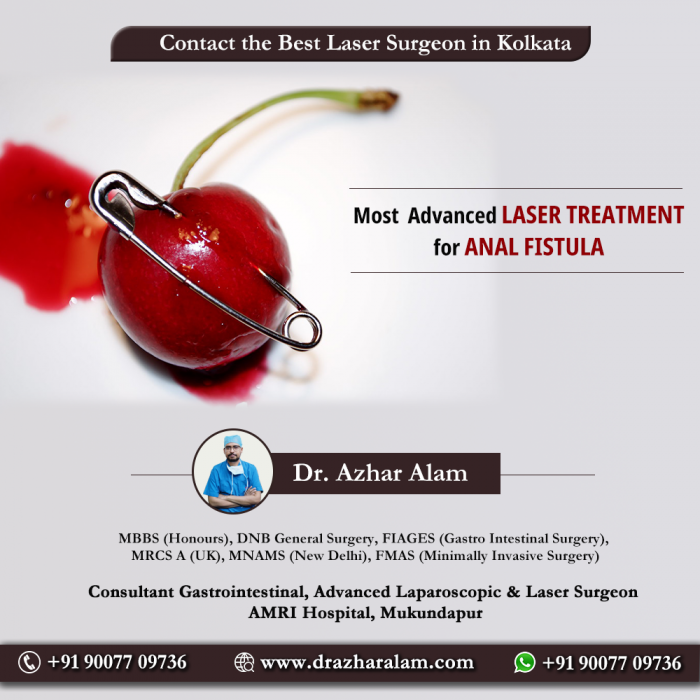 Fistula Doctor in Kolkata | Best Treatment for Fistula | Dr. Azhar Alam