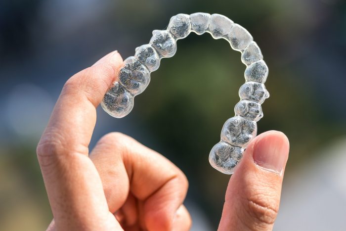 How to Clean Clear Retainers | What Is an Orthodontist?