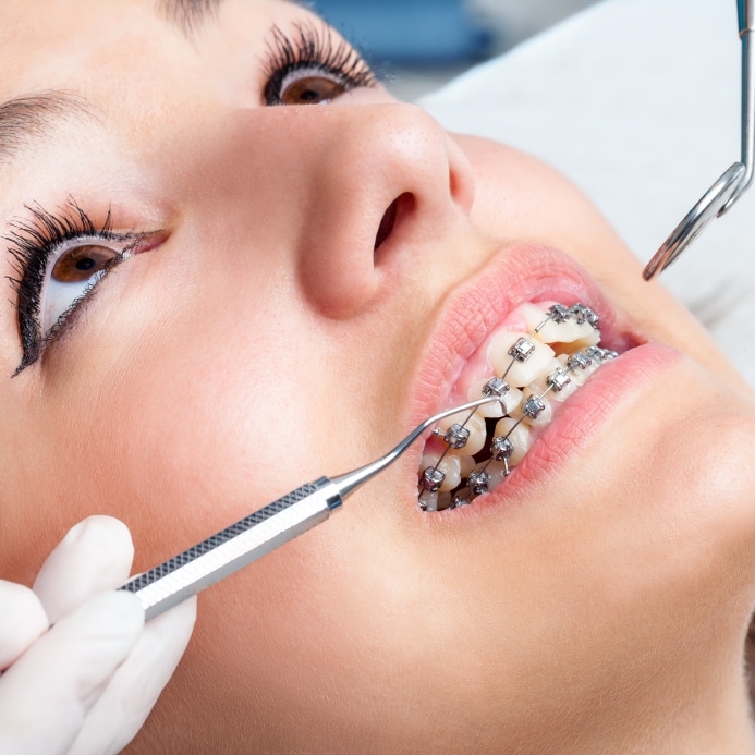 How Long Does it Take to Become an Orthodontist | Ivanov Orthodontic