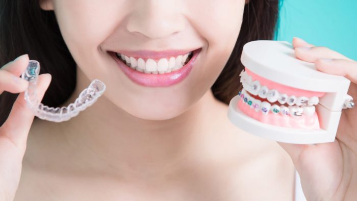 How Much Does Braces Cost for Teenagers? |What Is an Orthodontist?