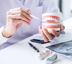Does Insurance Cover Teeth Whitening? | Urban Dental Centre