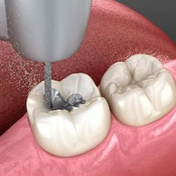 Best Nearest Dental Clinic | Cusp Dental