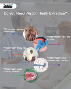 Do You Need Wisdom Teeth Extraction? How to Deal with These “Excess” Teeth