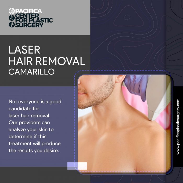 Get The Best Laser Hair Removal Camarillo for Your Body – Visit at Pacifica Center For Pla ...