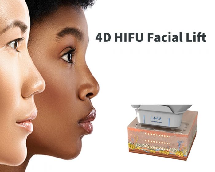 4D HIFU Facial Lift Machine