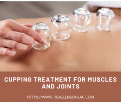 Cupping Treatment For Muscles and Joints