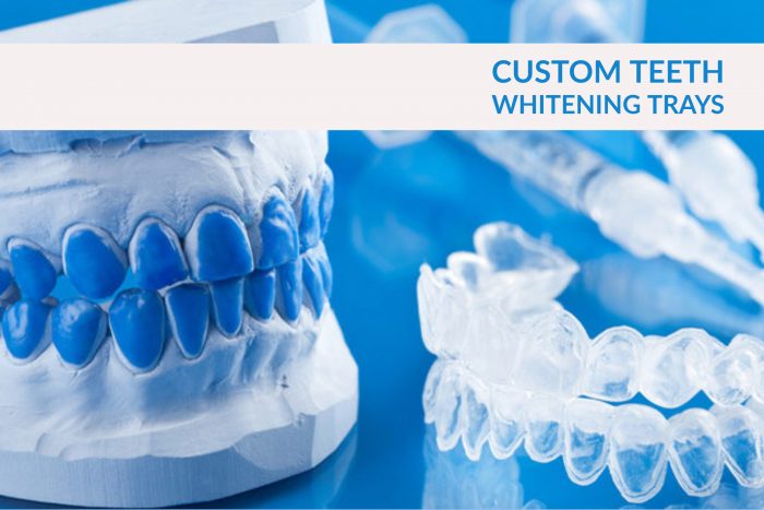 Custom Teeth Whitening Trays