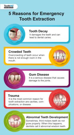 Top 5 Reasons For Emergency Tooth Removal