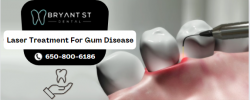 Care For Your Gum Disease With Laser Treatment