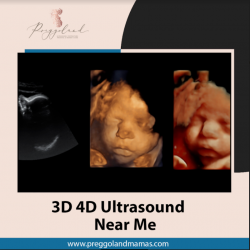3D 4D Ultrasound near me