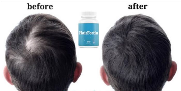 HairFortin Reviews – This 10-second Monk Ritual Supports Healthy Hair Growth!