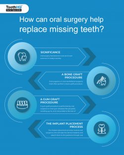 Types Of Oral Surgery Procedures For Replacing Missing Teeth