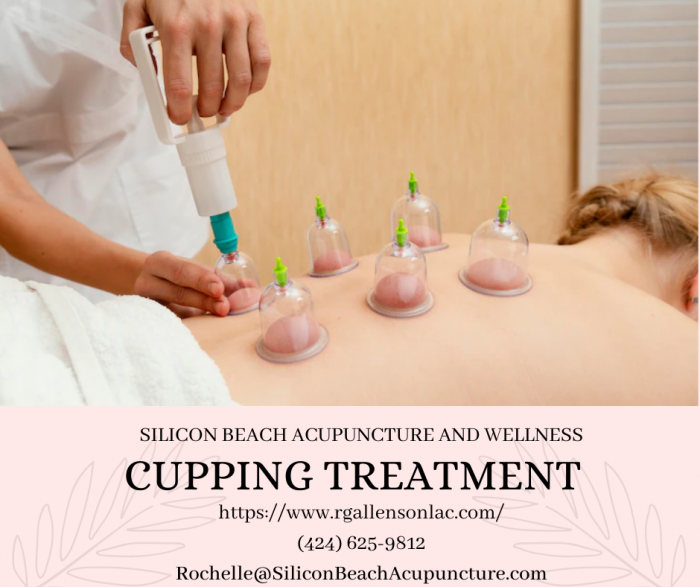 Most Reputed and Certified Cupping Therapy Center
