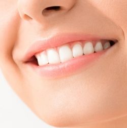 How Much Are Invisalign Braces | Ivanov Orthodontic Experts