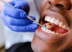 How You Can Find the Best Rated Orthodontist Near Me | Tooth Numbers