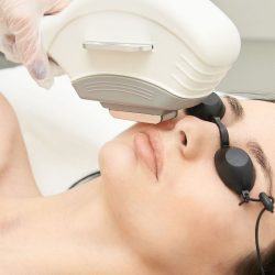 How much is laser hair removal?