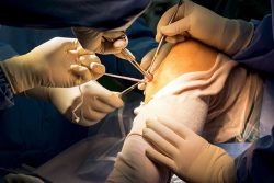 Arthroscopy Surgery In Delhi
