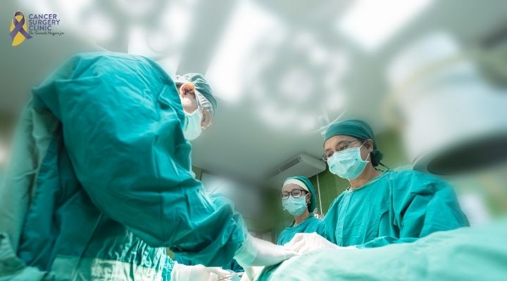 Doctor For Cancer Surgery in Mumbai