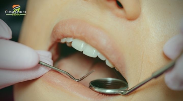 Solutions For Best Dentist in Bangalore