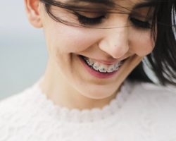 How Much Are Braces For Adults Ivanov Orthodontic Experts | Metal Braces