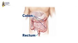 Cancer Surgeons Doctor For Colorectal in Mumbai