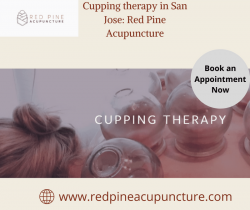 Cupping therapy in San Jose: Red Pine Acupuncture